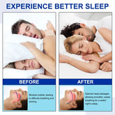 Anti-Snore Nose Strips, 30-Day Supply Nasal Dilator Opener, Effective Snoring Relief & Nighttime Breathing Support, Congestion Free Sleep