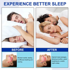 Anti-Snore Nose Strips, 30-Day Supply Nasal Dilator Opener, Effective Snoring Relief & Nighttime Breathing Support, Congestion Free Sleep